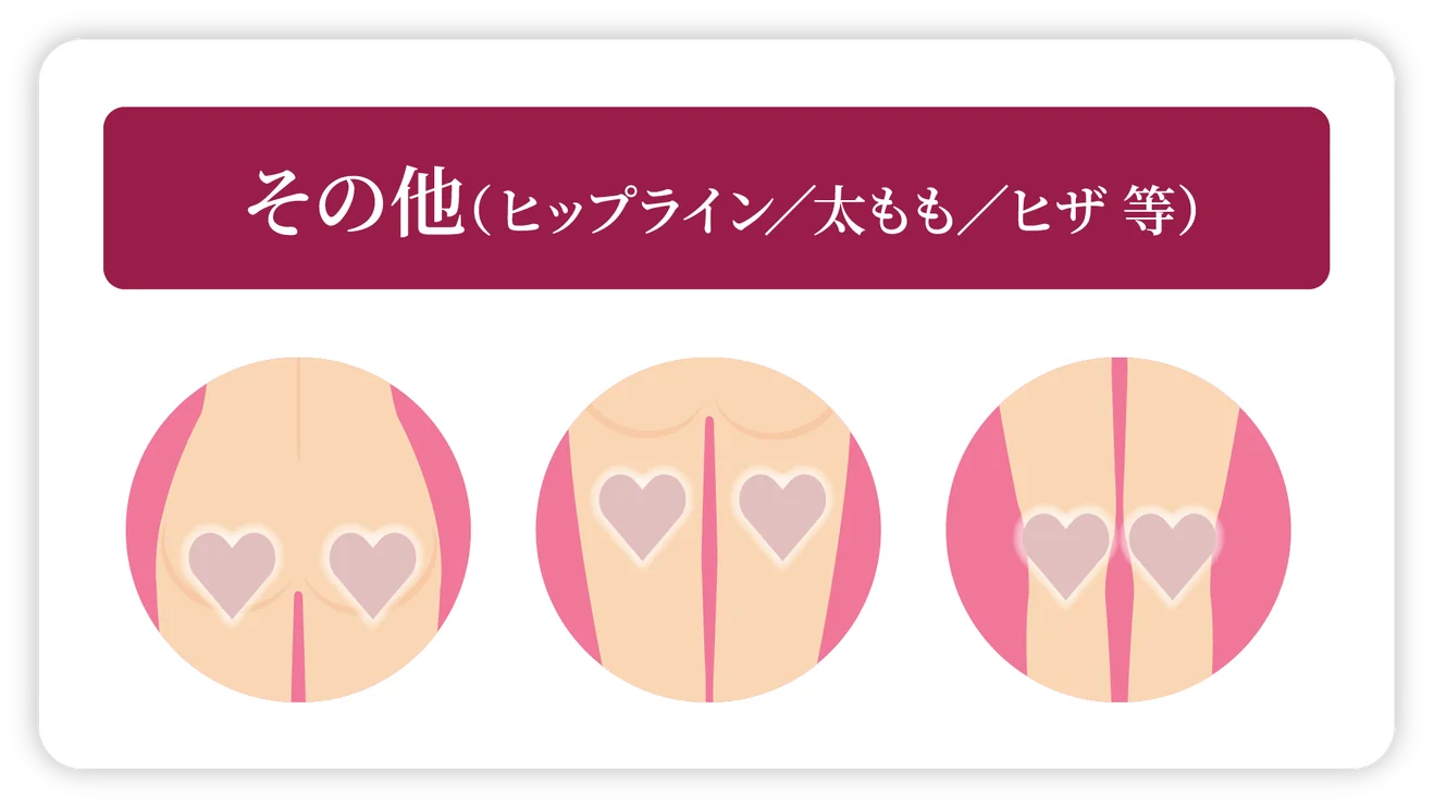 その他（ヒップライン／太もも／ヒザ 等）